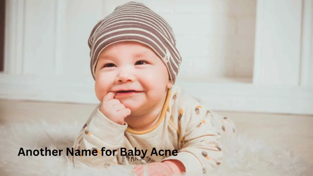 Another Name for Baby Acne