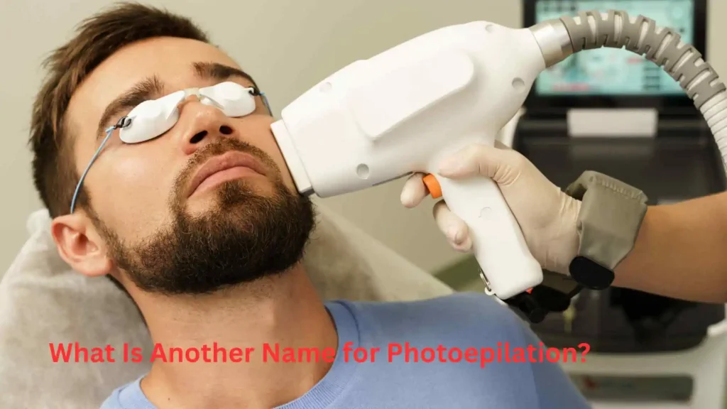 What Is Another Name for Photoepilation?