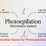 What Is Another Name for Photoepilation?